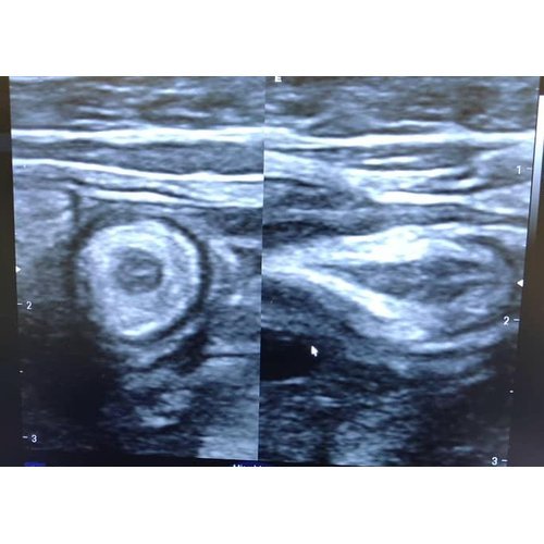 Indications and results of abdomino-pelvic ultrasound at Zinder National Hospital, Niger Republic.